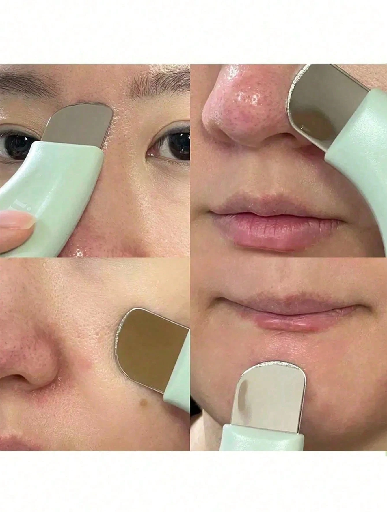 Extracteur de points noirs, Nettoyant de pores, Extracteur de points noirs du nez, Outil — vue 2