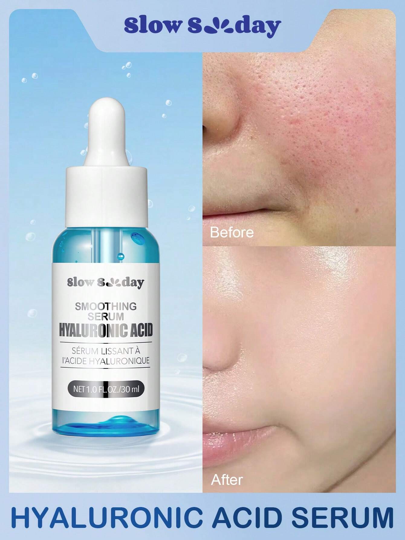 Sérum éclaircissant à la niacinamide SlowSunday, sérum resserre-pores, essence hydratante — vue 3